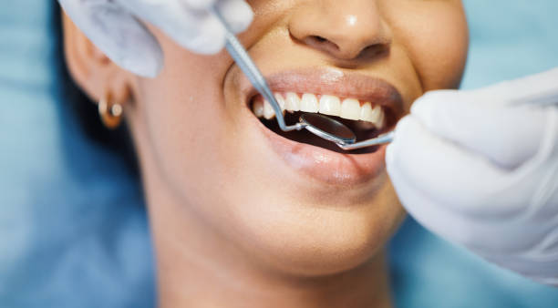 Best Emergency Wisdom Teeth Removal in Bressler, PA