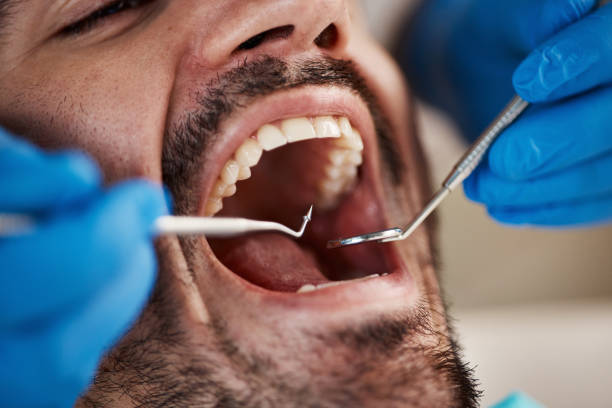 Best Urgent Care for Lost Fillings or Crowns in Bressler, PA